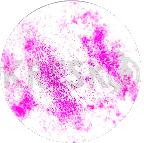 Methylobacterium symbioticum
